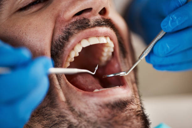 Best Chipped Tooth Repair Near Me  in Smithville, NJ